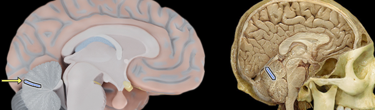 <p>Primary fissure of cerebellum</p>