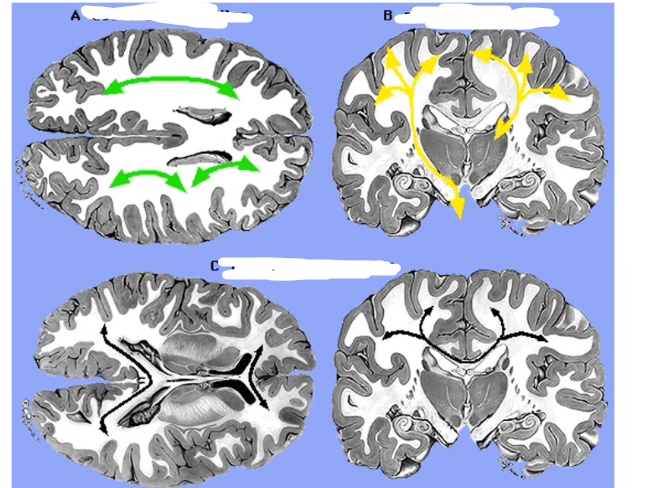 <p>pyramidal cells axons - white matter bundles, A _____ _____ are tracts that are anterior to posterior and include _____ ______, B ____ _____ are tracts that communicate with subcortical regions like brainstem and include _____ ______, C _____ ____ are tracts that communicate between hemispheres and include _____ _____  and _____ ______ </p>