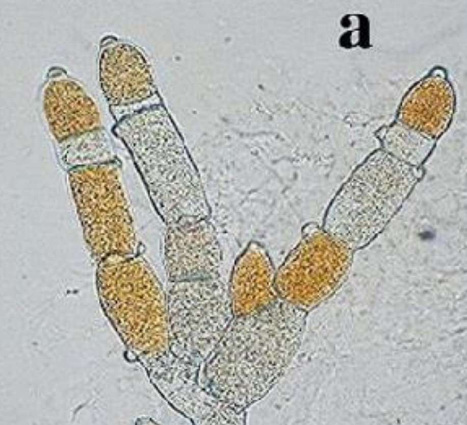 <p>mainly aquatic, saprotrophic</p>