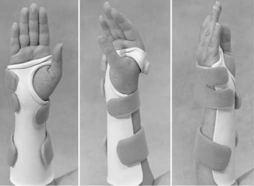 <p>what is the name, type and purpose of this UE orthotic?</p>