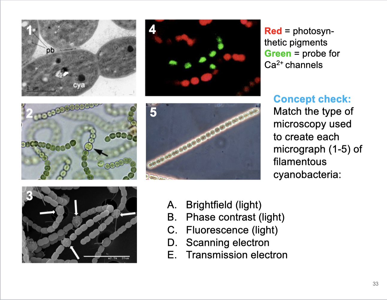 <p>Match the type of microscopy used to create each micrograph of filamentous cyanobacteria</p>
