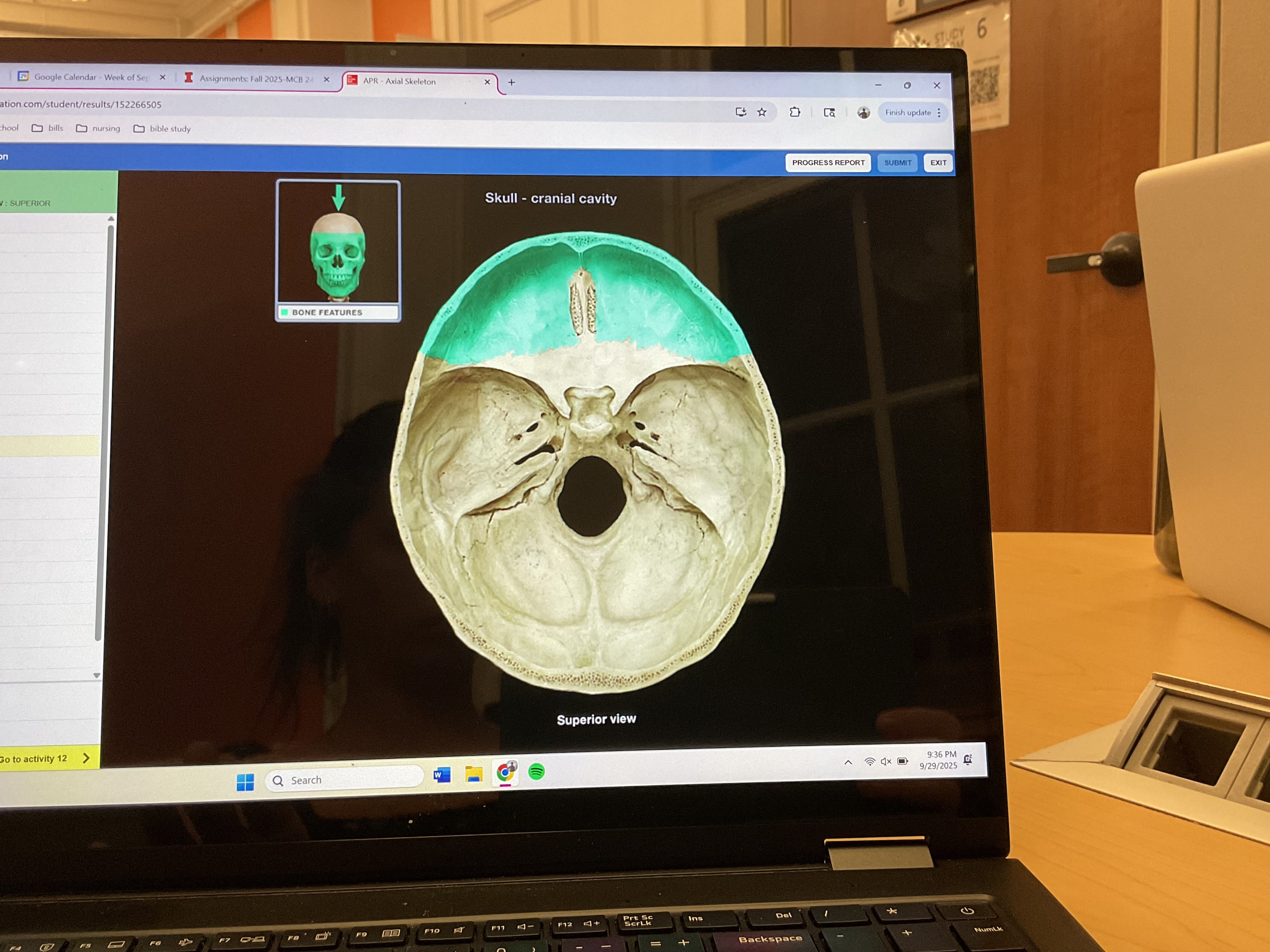 <p>Frontal bone </p>