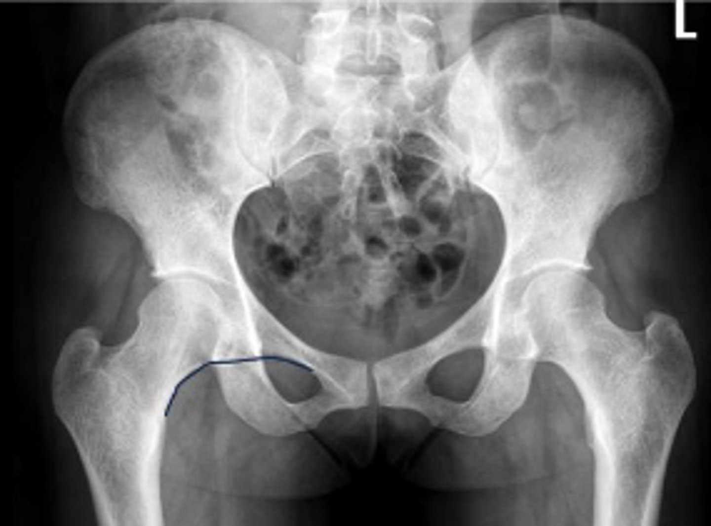 <p>What is the name of the assessment?</p>