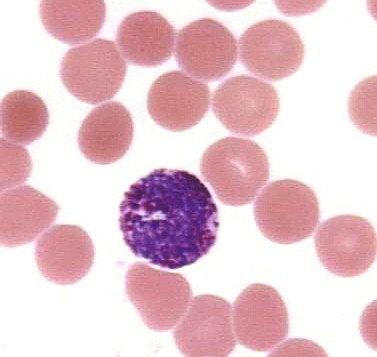 <p>which leukocyte is this?</p>