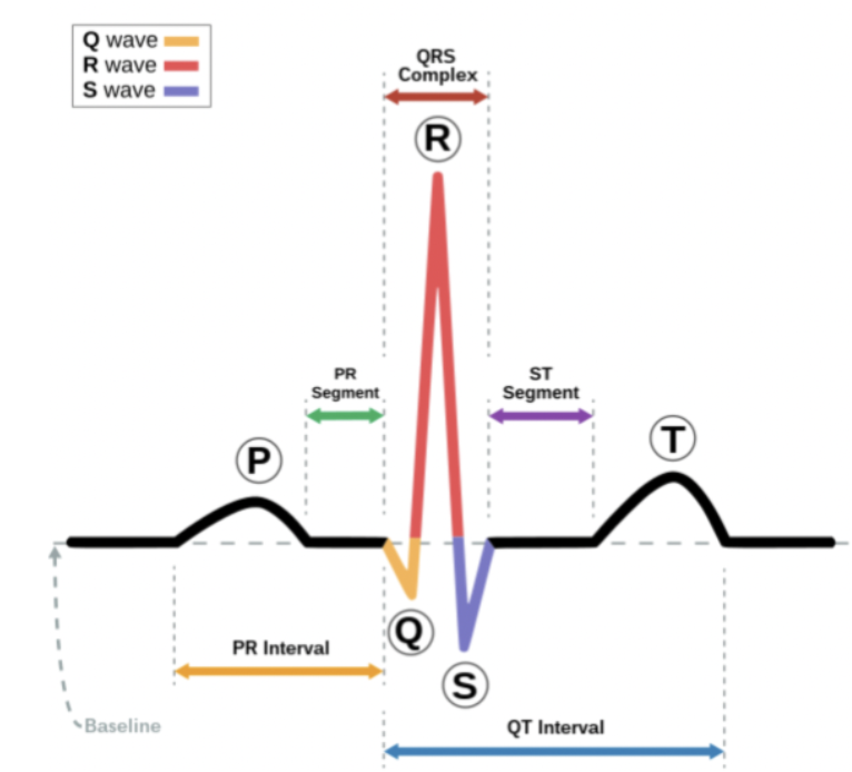 <p>QT interval</p>