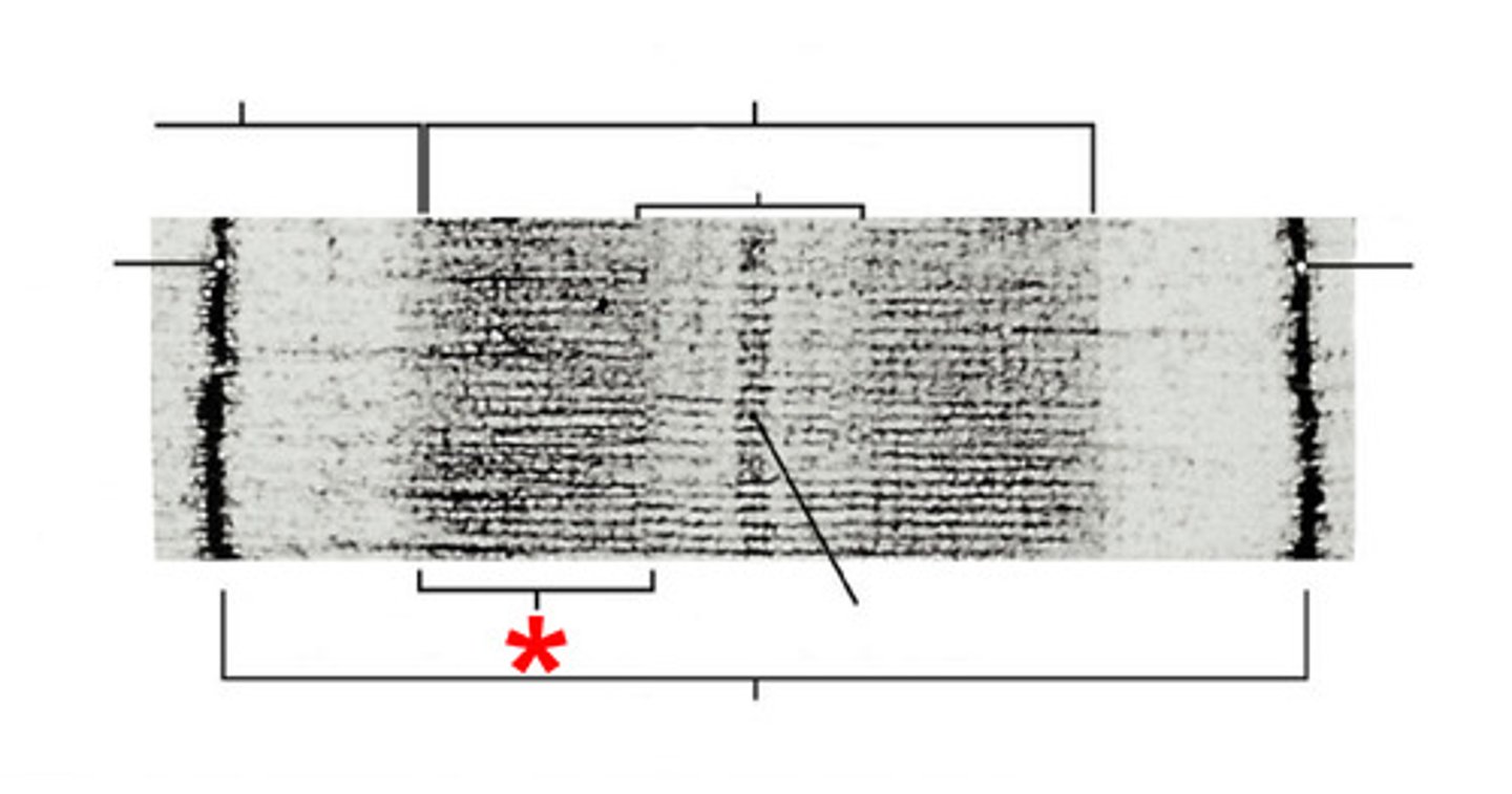 <p>Both thick and thin filaments</p>