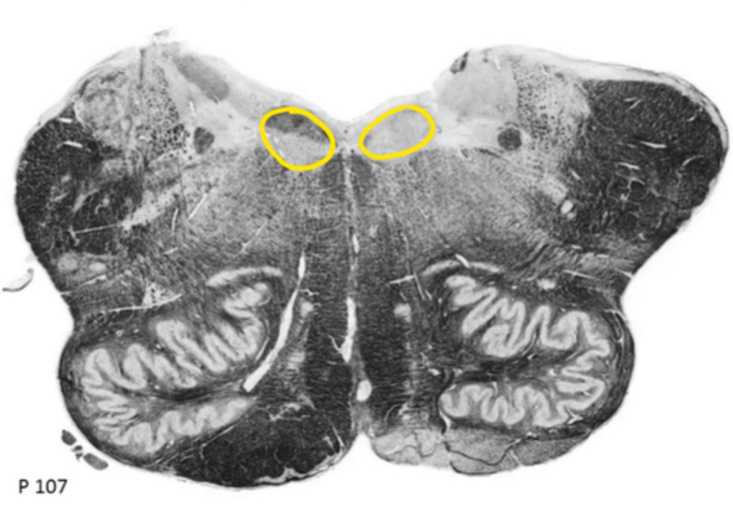 <p>ID the nucleus</p>