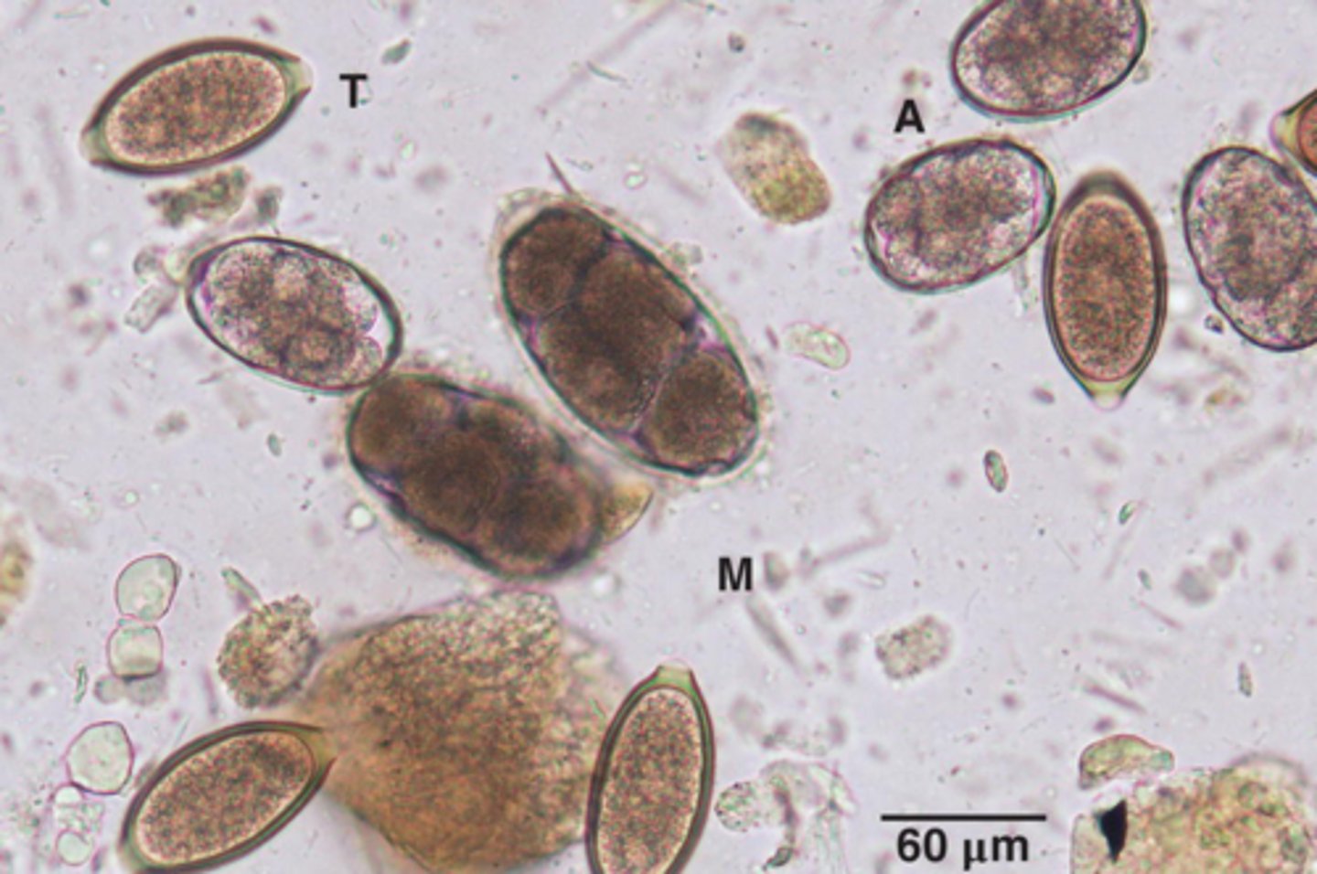 <p>What parasite is T if it is from a dog</p>