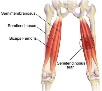<p>middle hamstring</p>