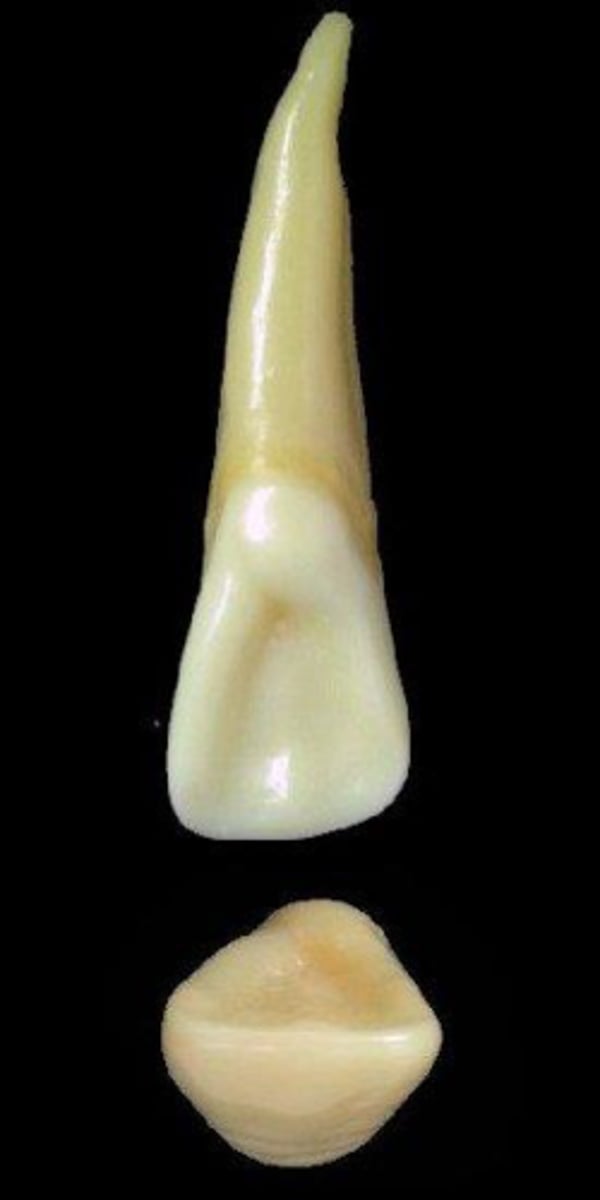 <p>what tooth is this &amp; why?</p>