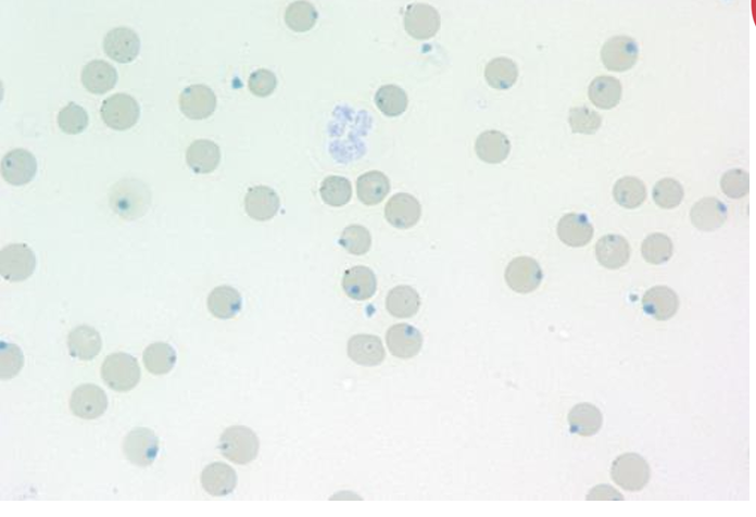 <p>What abnormality can you see in this image?</p>