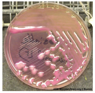 <p>MacConkey agar</p>