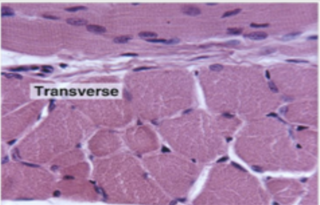 <p>histological appearance of transverse skeletal muscle</p>
