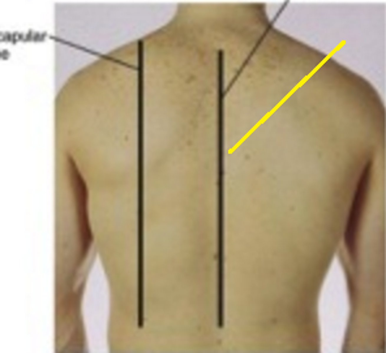<p>A line running vertically down through the spinous processes of the spine</p>
