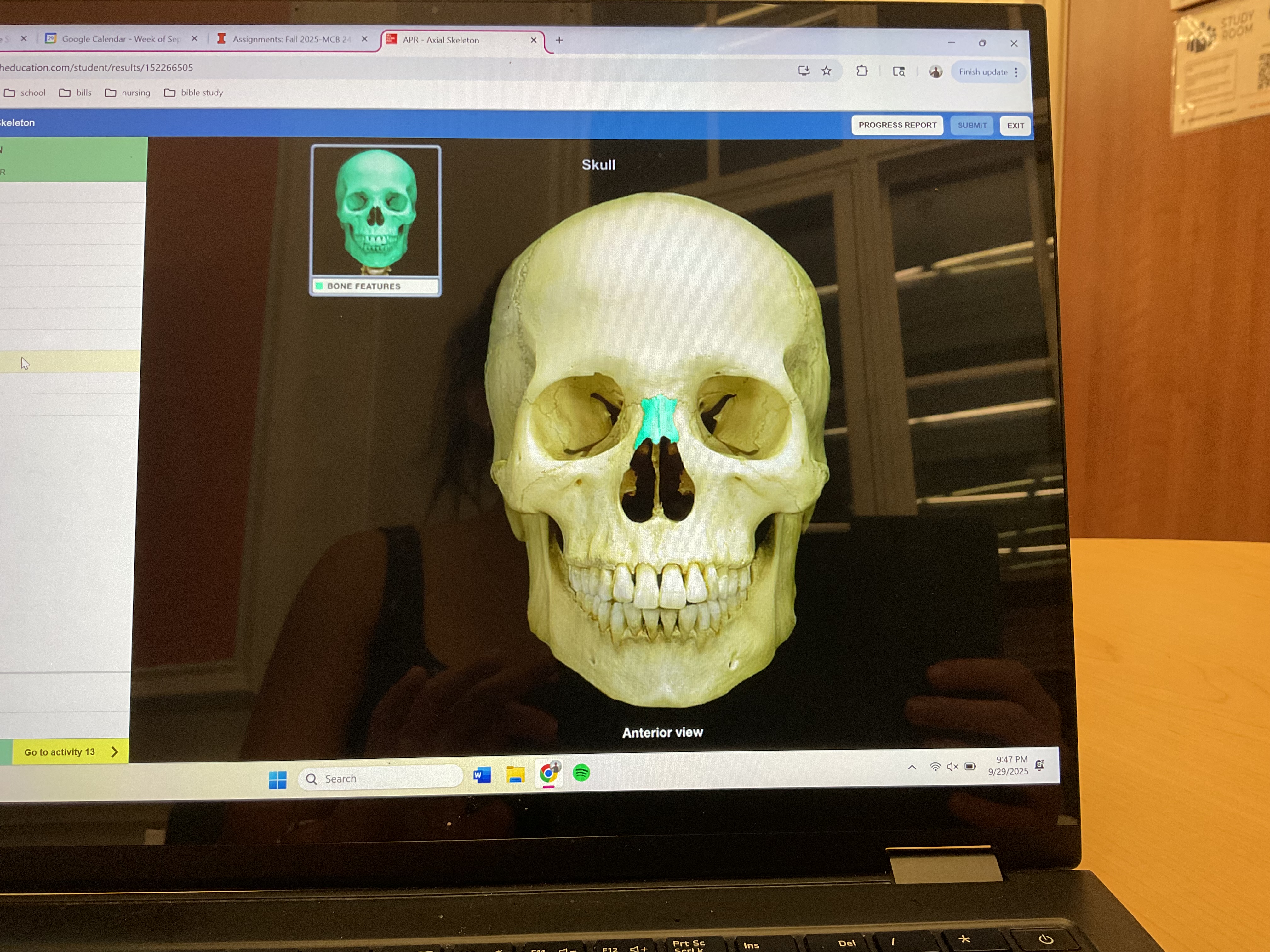 <p>Nasal bone </p>