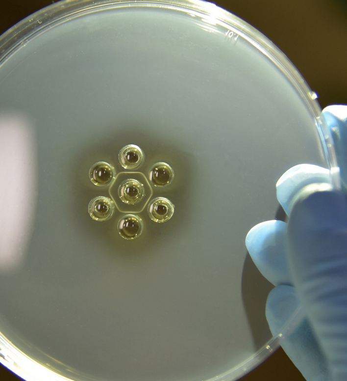 <p>1. serology (coggins test): AGID, ELISA</p><p>-seroconversion in 10-14 days post infection</p><p>2. rule out other causes of thrombocytopenia/anemia/vasculitis</p><p>-anaplasmosis, EVA, purpura, AHS</p>