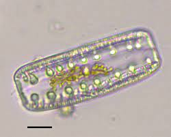 <p>What type of view of the diatom is this?</p>