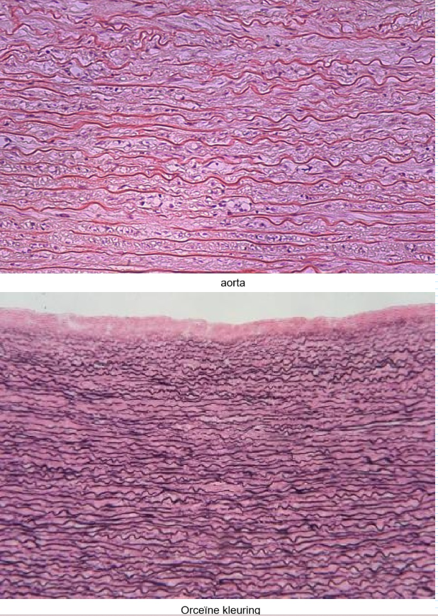 <ul><li><p>uit bundels dikke elastische vezels</p></li><li><p>tussen dikke elastinevezels: enkele fibroblasten</p></li><li><p>grote dichtheid aan elastische vezels geeft het geheel een gele kleur &amp; grote elasticiteit</p></li><li><p>‘puur’ (‘zuiver’) elastisch bindweefsel: komt maar op enkele plaatsen voor: </p><ul><li><p>gele ligamenten van de wervelkolom → ligamentum flavum</p></li><li><p>ligamentum suspensorium van de penis</p></li></ul></li><li><p>in sommige soorten dicht bindweefsel: aandeel van elastine is aanzienlijk</p><ul><li><p>bv. in de reticulaire dermis van de huid (neemt af met leeftijd)</p></li><li><p>bv. in grote bloedvaten zoals aorta</p></li></ul></li></ul><p></p>