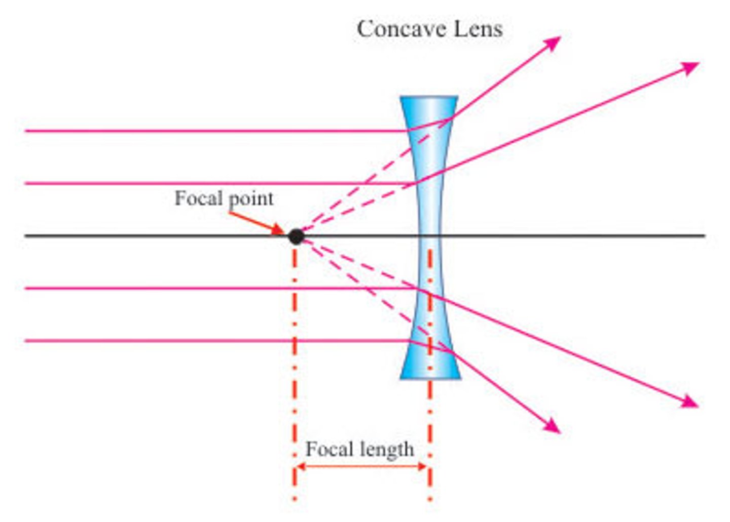 <p>a lens that is thinner in the middle than at the edges</p>