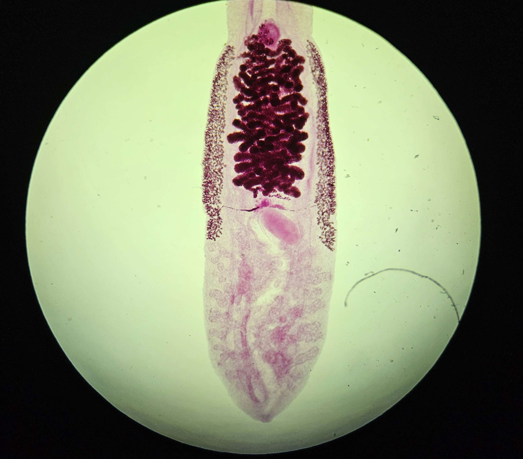 <p><span data-name="microscope" data-type="emoji">🔬</span><span data-name="petri_dish" data-type="emoji">🧫</span><strong><span> </span>Na podstawie zdjęcia preparatu:</strong></p><p></p><ul><li><p><span data-name="book" data-type="emoji">📖</span><span> </span>rozpoznaj gatunek pasożyta;</p></li></ul><p></p><ul><li><p><span data-name="recycle" data-type="emoji">♻</span><span> </span>rozpoznaj wszystkie formy rozwojowe;</p></li></ul><p></p><ul><li><p><span data-name="microbe" data-type="emoji">🦠</span><span> </span>wskaż organelle i cechy charakterystyczne dla danego gatunku;</p></li></ul><p></p><ul><li><p><span data-name="mask" data-type="emoji">😷</span><span> </span>nazwij chorobę, którą pasożyt wywołuje.</p></li></ul><p></p>