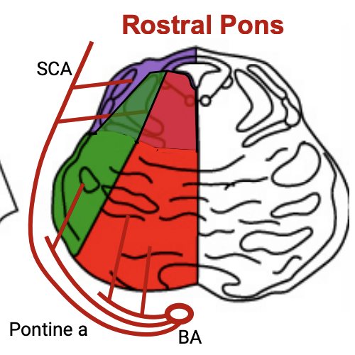 <p><strong>Superior cerebellar arteries</strong></p><p>Pontine arteries</p><p>Superior cerebellar arteries</p>