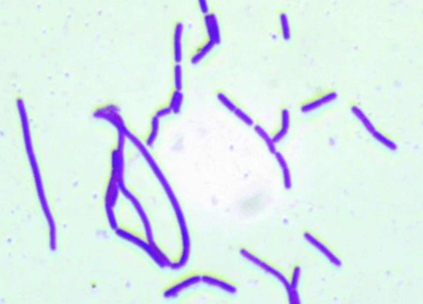 <p>coccus or rods?</p><p>G+ or G-?</p>