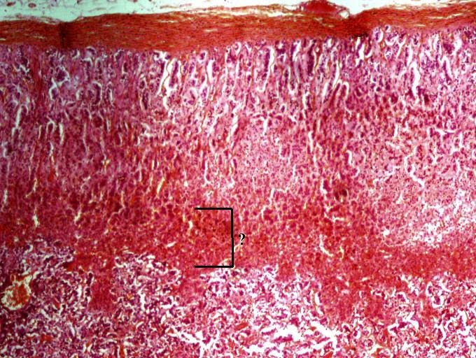 <p><span><span>Identify the indicated layer of the adrenal gland.</span></span></p>