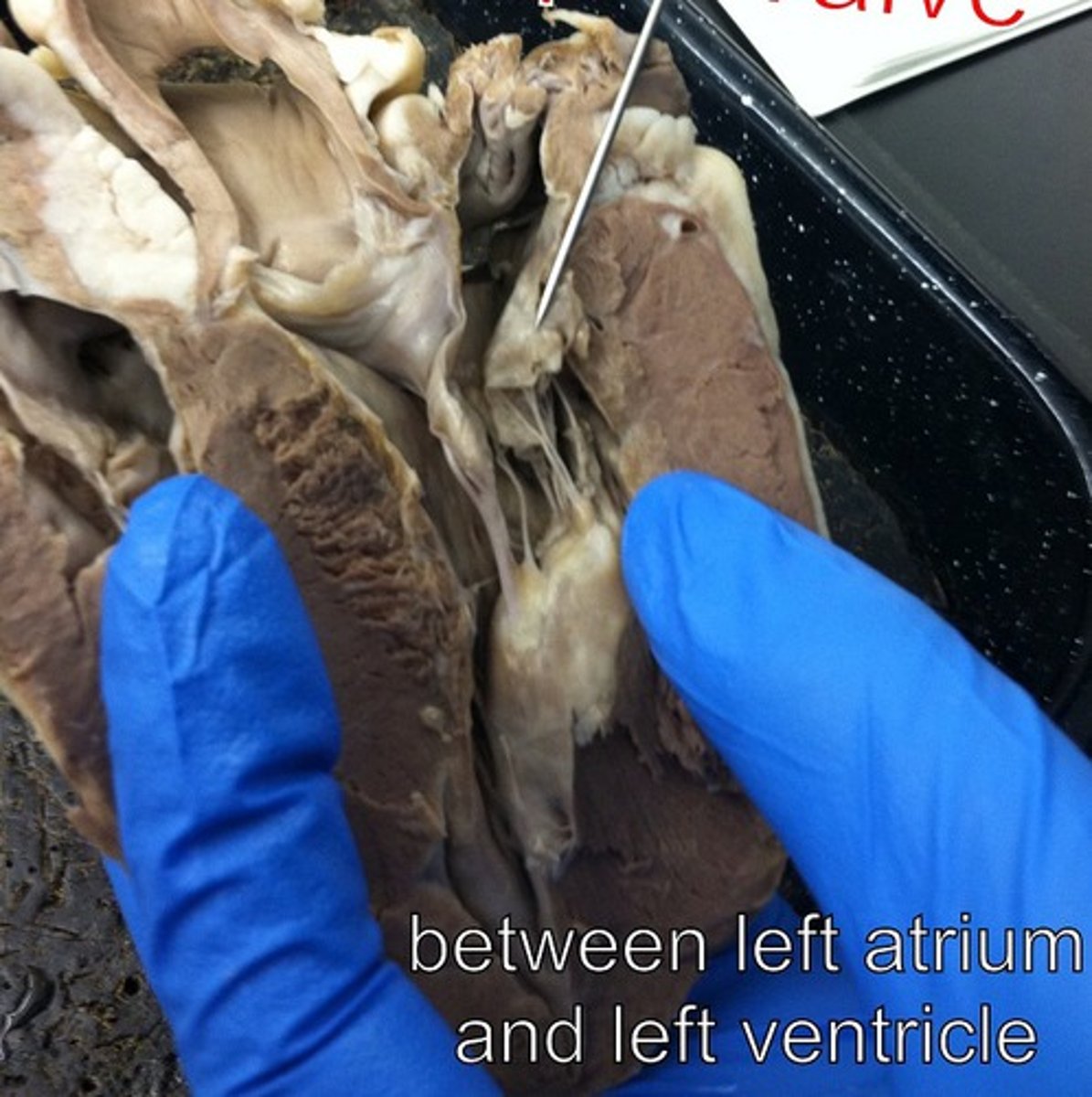 <p>Identify this valve:</p>