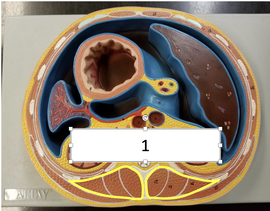 <p>name the muscle (1)</p>