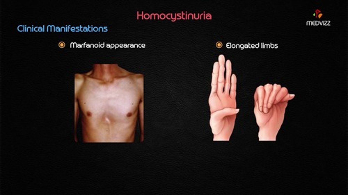 <p>Increased homocysteine due to inability to break down methionine.</p>