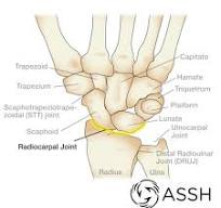 <p><strong>Radiocarpal </strong>joint (_________; wrist flexion, extension in sagittal plane and wrist abduction, adduction in frontal plane).</p>
