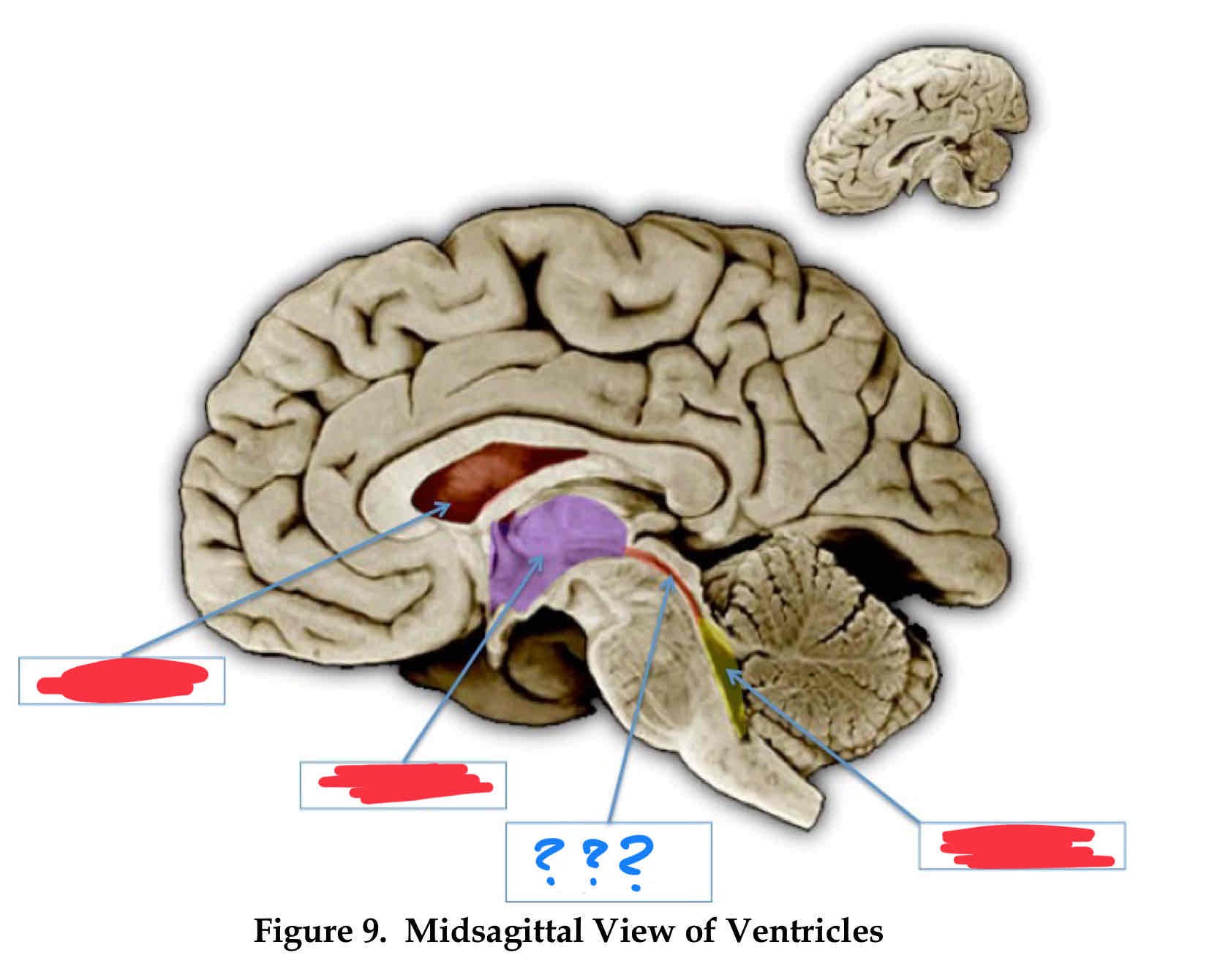 <p>below third</p>