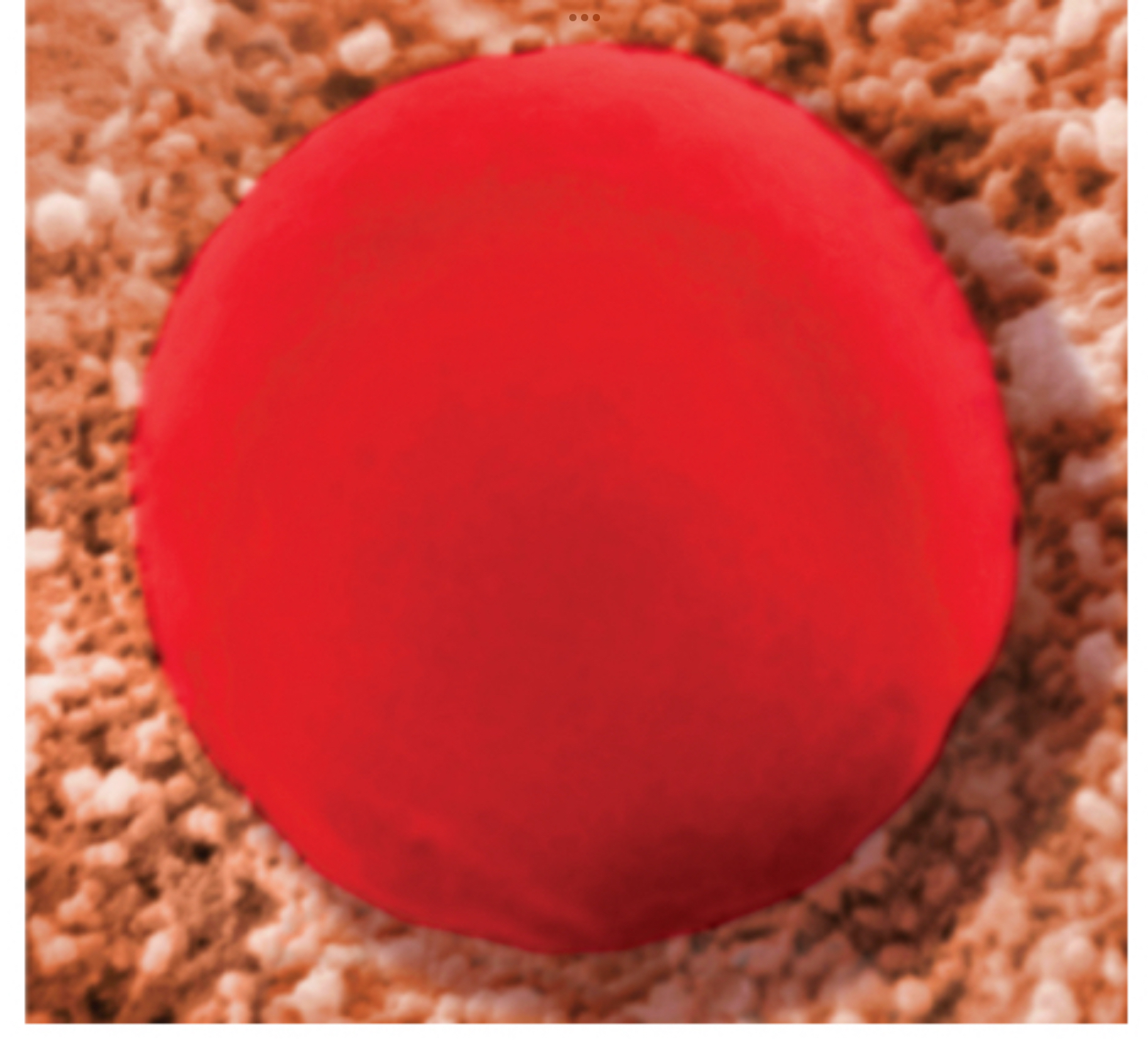 <ul><li><p>solution has a <strong>lower</strong> concentration of nonpermeating solutes than the intracellular fluid.</p></li><li><p>Causes cells to <strong>lose</strong> water and shrivel</p></li><li><p><strong>inside</strong> cell</p></li></ul>