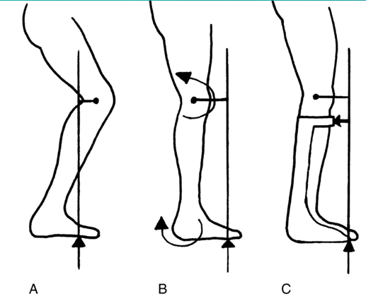 <p>what kind of gait correction is C?</p>