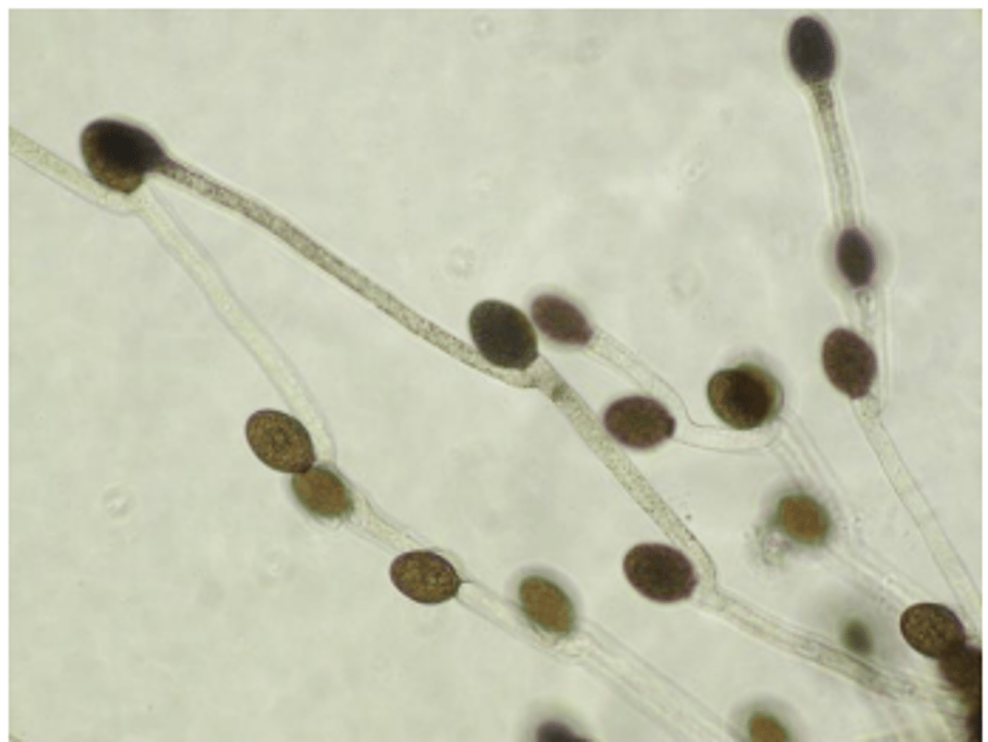 <p>Chytridiomycota (voorbeeld)</p>