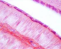<p>column, hairs on side </p>