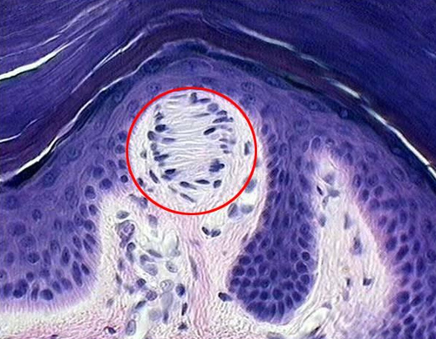 <p>Which corpuscle is this?</p>