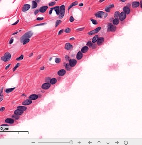 <p>simple cuboidal epithelium</p>