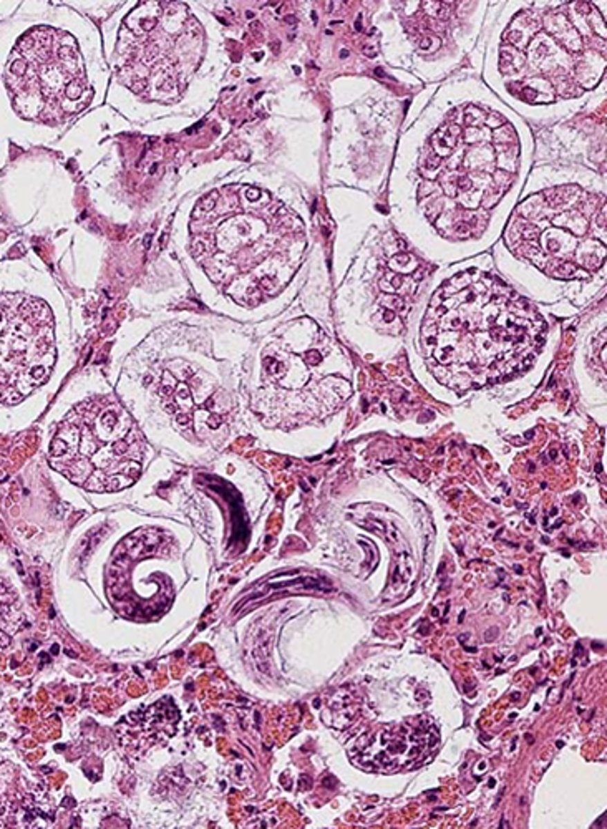 <p>What are the worms seen on this histopath section of lung parenchyma from a coughing dog?</p>