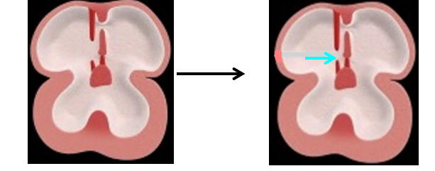 <ul><li><p><strong><mark data-color="red">thick, muscular, right</mark></strong></p></li><li><p><strong><mark data-color="red">overlaps, foramen secundum</mark></strong></p></li><li><p><strong><mark data-color="red">oval, ovale, atria</mark></strong></p></li></ul>