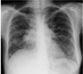 <p>what is this? and what causes it</p>