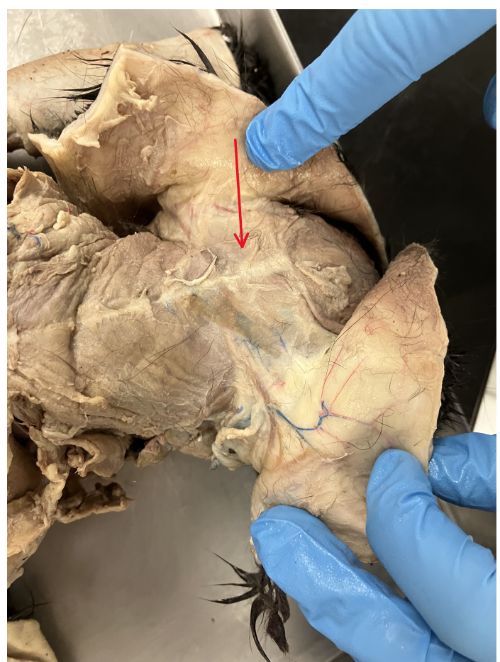 <p>What is the innervation of this muscle?</p>