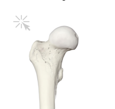 <p>Hoe heten deze uitsteeksels</p>