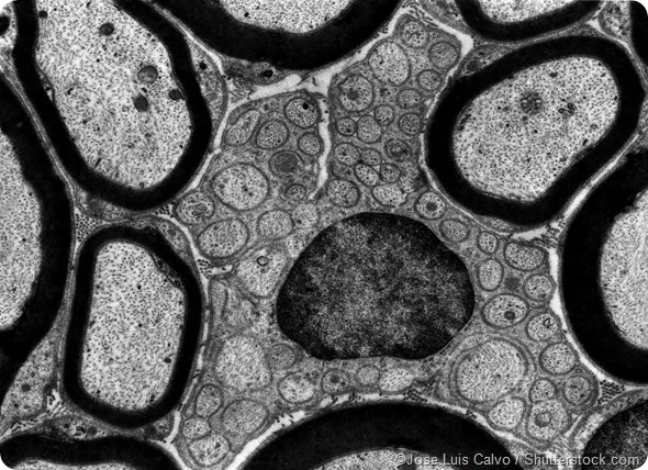<p>Electron microscopy</p>