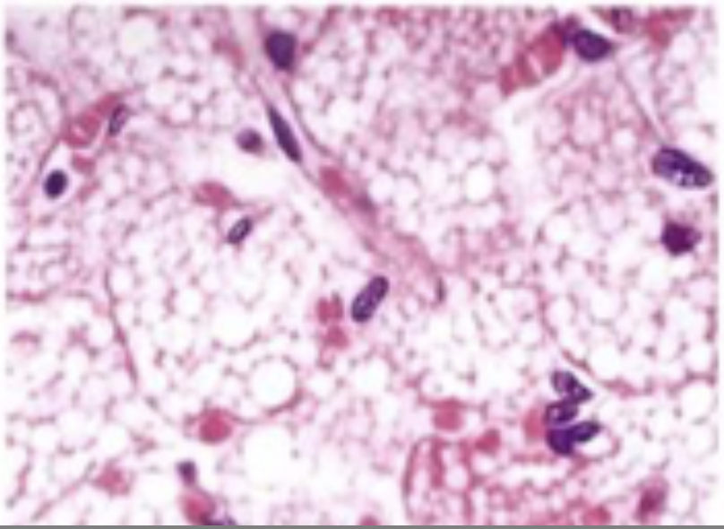 <p>large, rounded nuclei, vacuolar-looking tissues inside cell instead of large cytoplasm space</p>