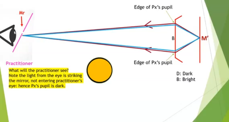 <p>will either see a full pupil, or nothing, as the ble rays dont pass through the gap in the mirror&nbsp;</p><p>when light leaves px eye and brought to focus at ret mirror, then flash will be seen&nbsp;</p><p></p>