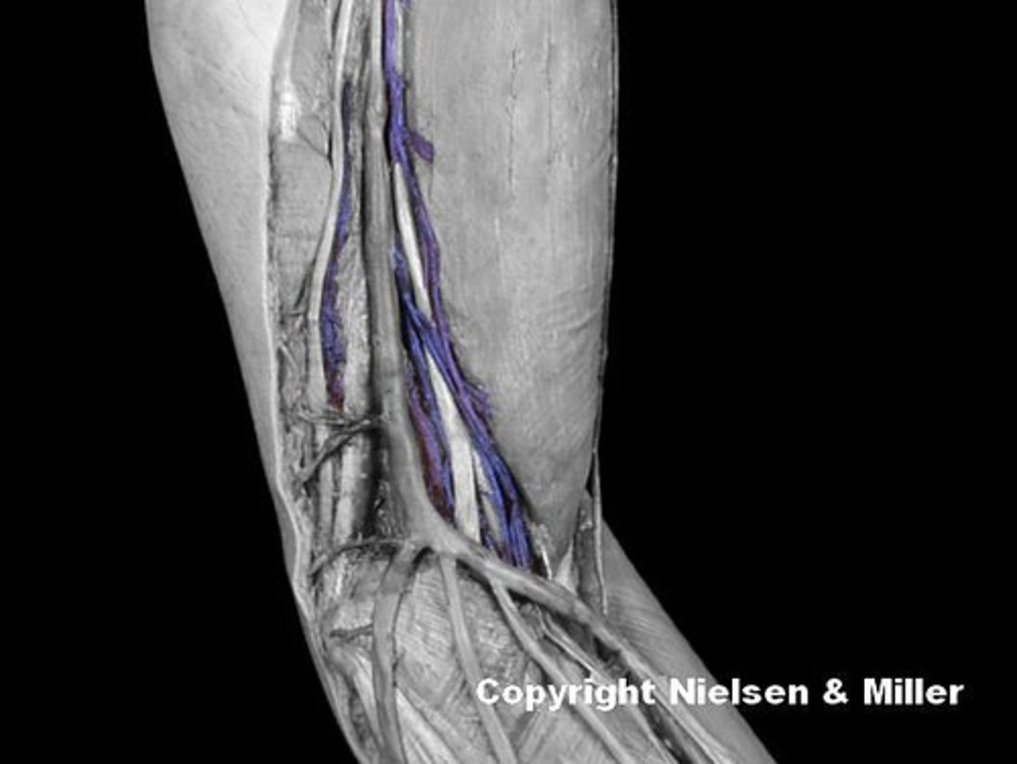<p>Identify the highlighted vessel (anteromedial view of superficial veins of arm/forearm).</p>