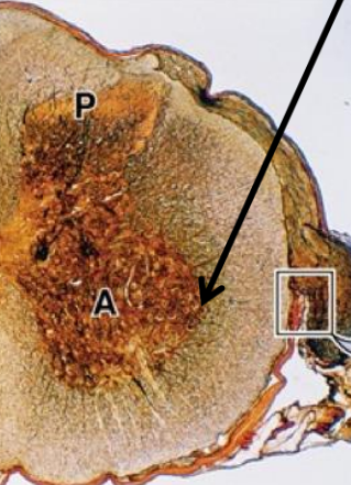 <p>WHAT MATTER OF THIS CROSS CUT SECTION?</p>