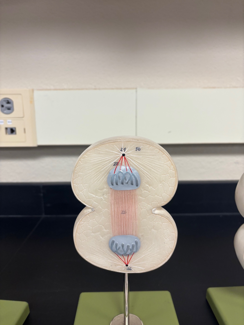 <p>What stage of mitosis is this? </p>
