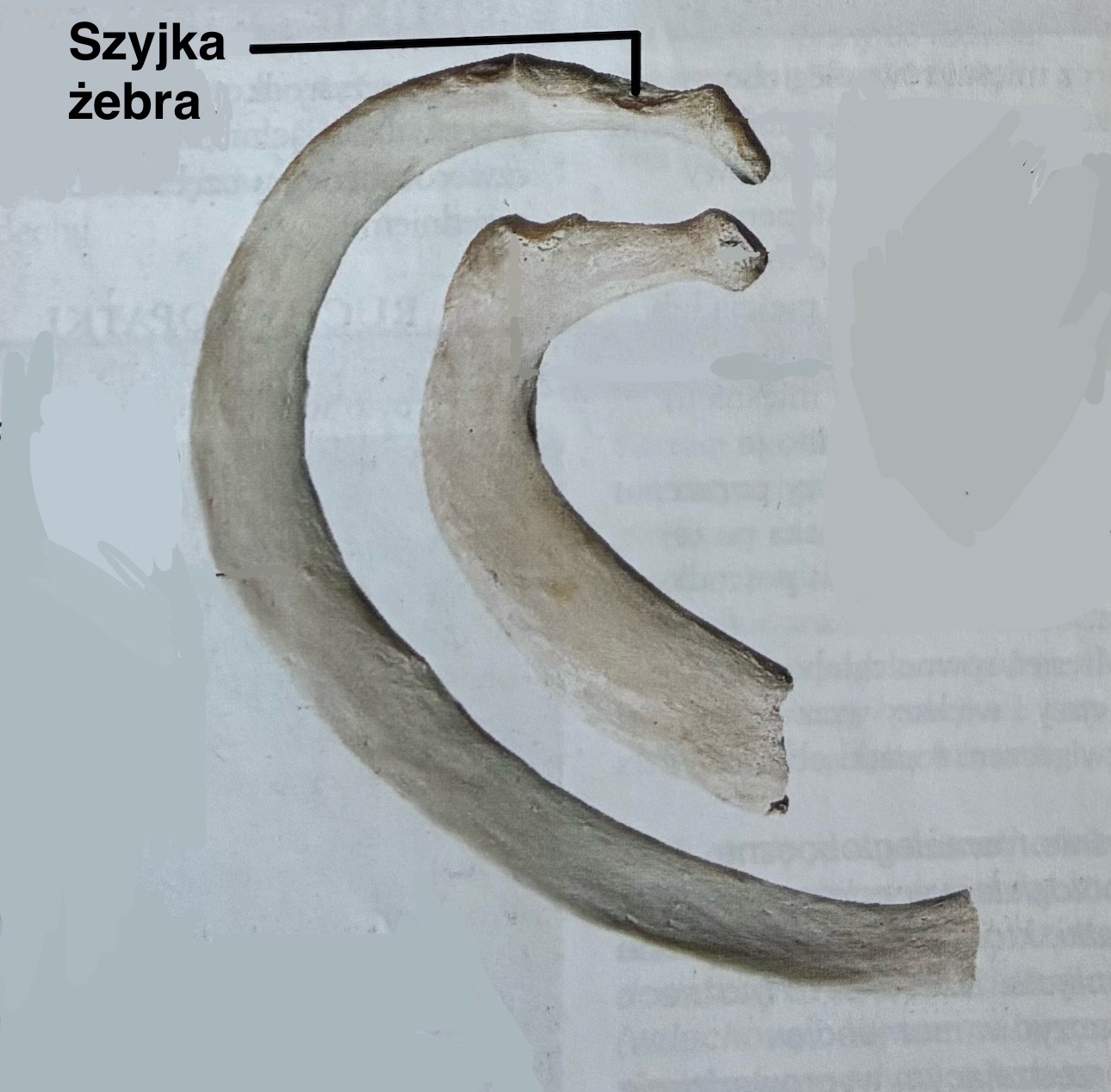 <p>Szyjka żebra</p><p>(z opisem)</p>